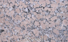 ROSAVEL   GRANITE